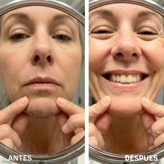 Serum Renovia: Recupera tu confianza y la suavidad de tu piel.