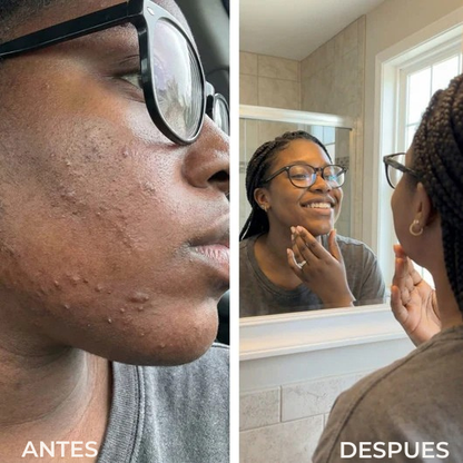 Serum Renovia: Recupera tu confianza y la suavidad de tu piel.