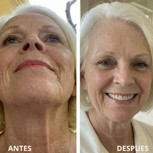 Serum Renovia: Recupera tu confianza y la suavidad de tu piel.