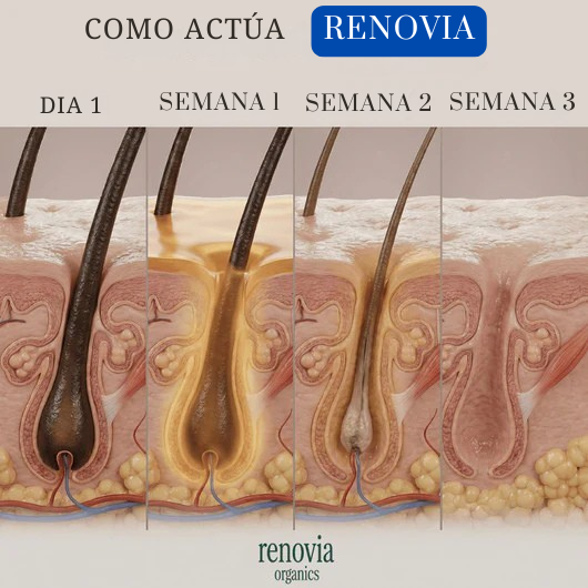 Serum Renovia: Recupera tu confianza y la suavidad de tu piel.